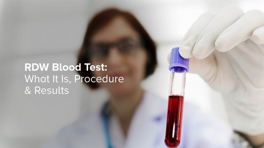 Demystifying the RDW Blood Test for Better Health Insights