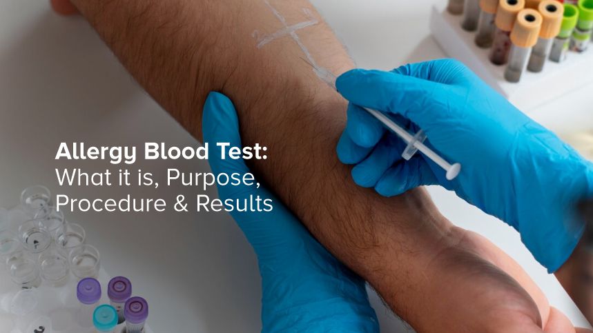 Discovering the Truth About Allergy Blood Tests for Better Health