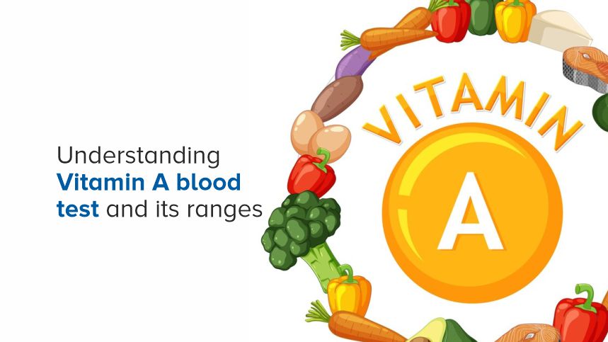 Decode Your Vitamin A Blood Test for Better Health