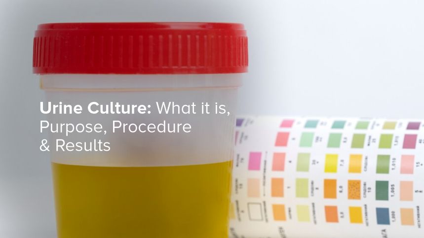 Understanding Urine Culture Tests and Their Importance for Your Health