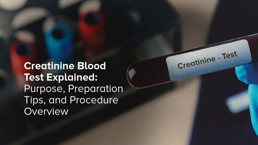 Demystifying the Creatinine Blood Test and Its Vital Role in Your Health