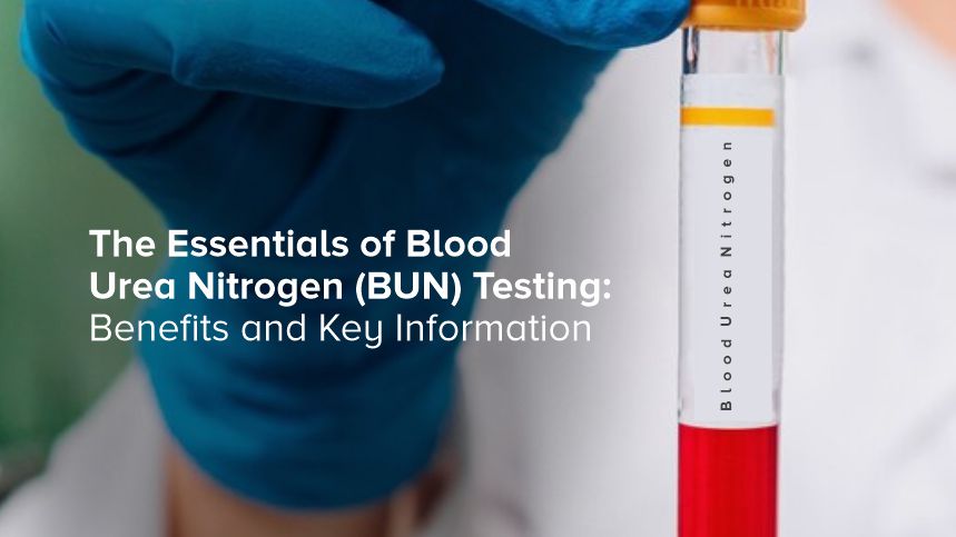 Understanding Blood Urea Nitrogen Testing for Better Health