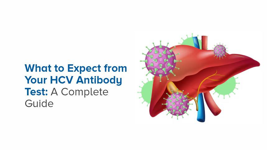 Your Essential Guide to the HCV Antibody Test