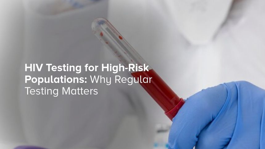 Stay Ahead of HIV: The Vital Importance of Regular Testing for High-Risk Populations