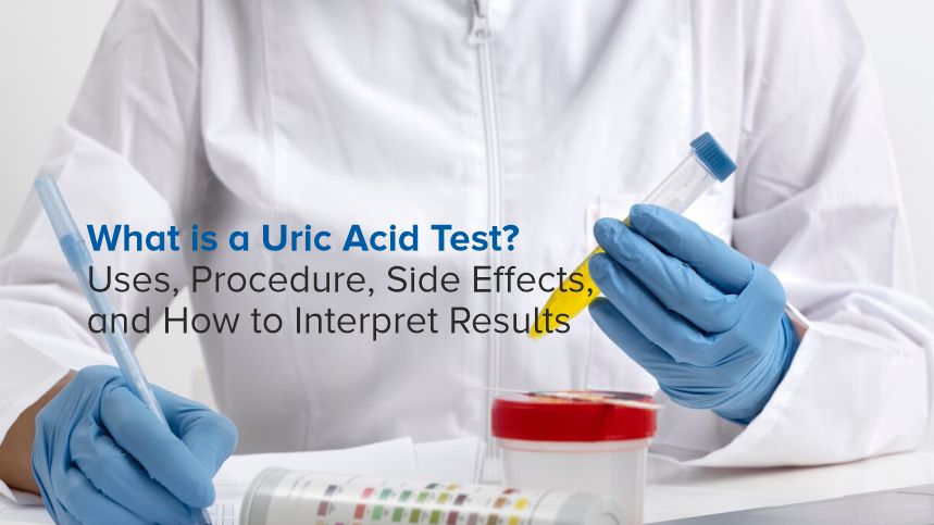 Understanding Uric Acid Tests and Their Importance for Your Health