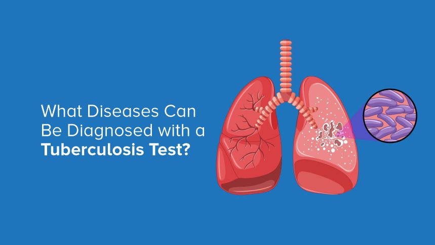 Discover the Hidden Health Insights from a Tuberculosis Test