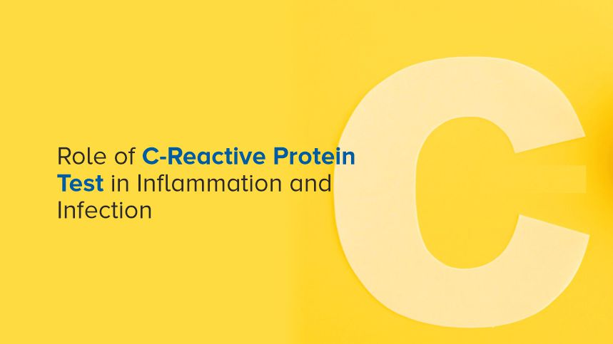 Discover the Hidden Power of C-Reactive Protein Test in Detecting Inflammation and Infection