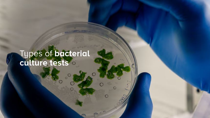 The Fascinating World of Bacterial Culture Tests You Need to Know About