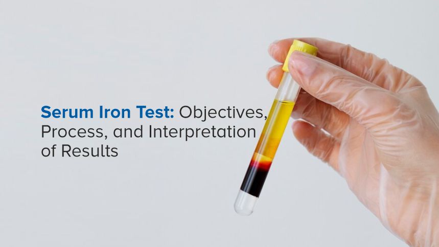 Demystifying the Serum Iron Test Objectives Process and Interpretation