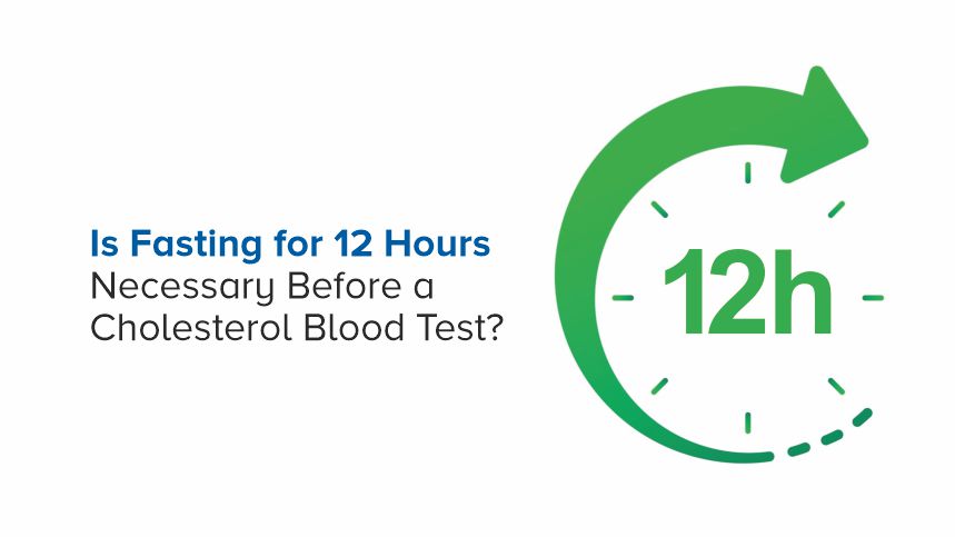 Is Fasting for 12 Hours Necessary Before a Cholesterol Blood Test?