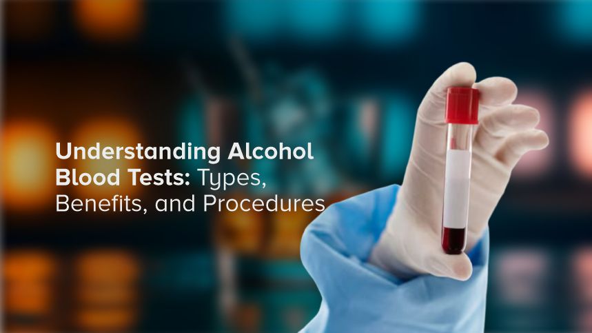 Decoding Alcohol Blood Tests for Better Health Decisions