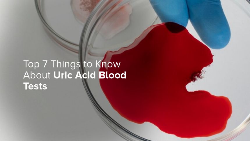 Understanding Uric Acid Blood Tests and Why They Matter