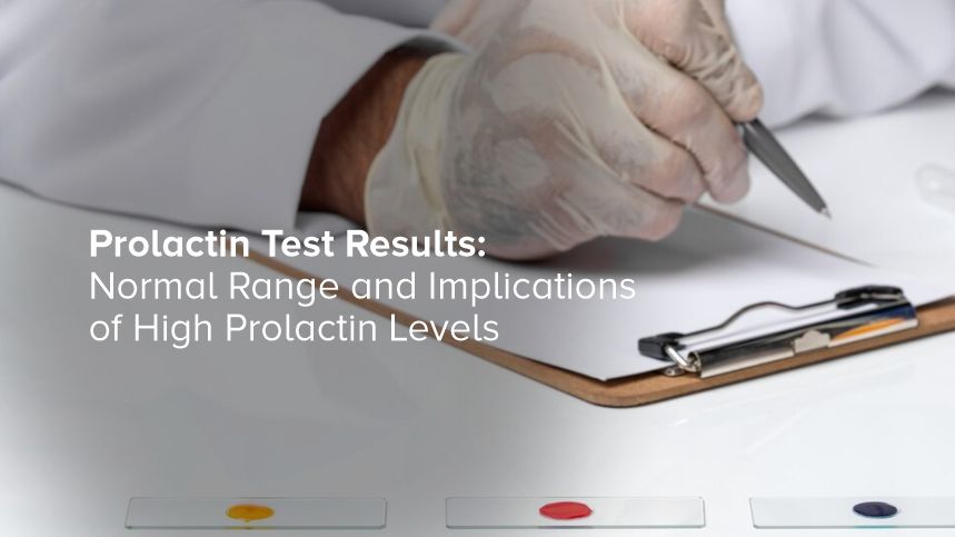 Decoding Prolactin Test Results and What High Levels Mean for You