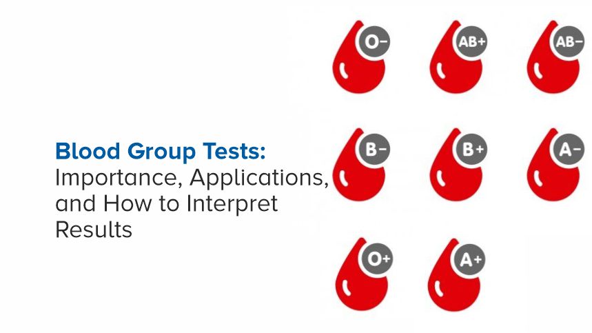 Decode Your Blood Type The Essential Guide to Testing and Understanding