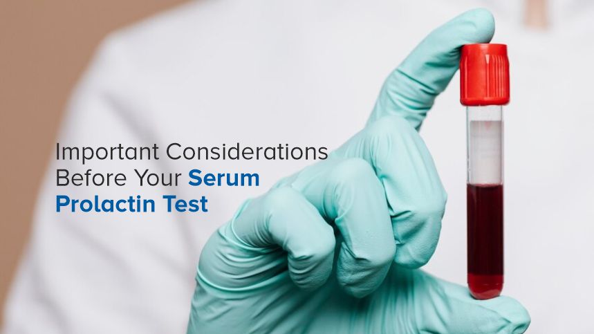 Navigating the Quest for a Serum Prolactin Test