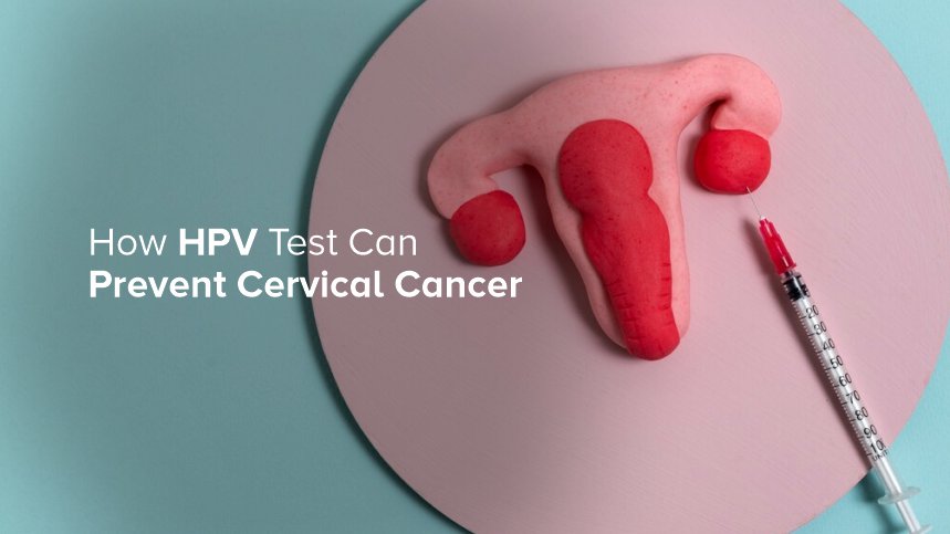 How HPV Testing Can Help Prevent Cervical Cancer