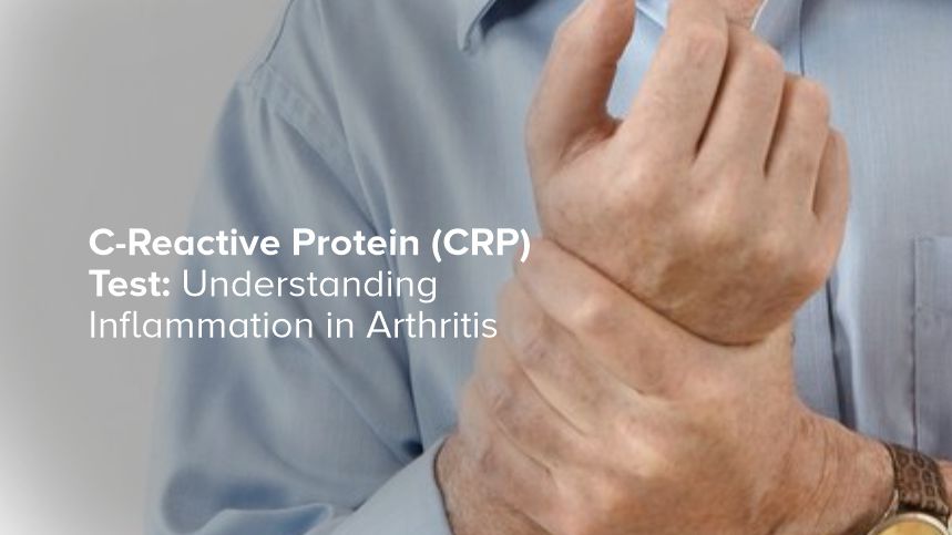 C-Reactive Protein (CRP) Test: Understanding Inflammation in Arthritis