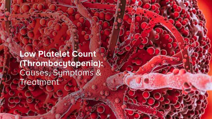 Low Platelet Count (Thrombocytopenia): Causes, Symptoms & Treatment