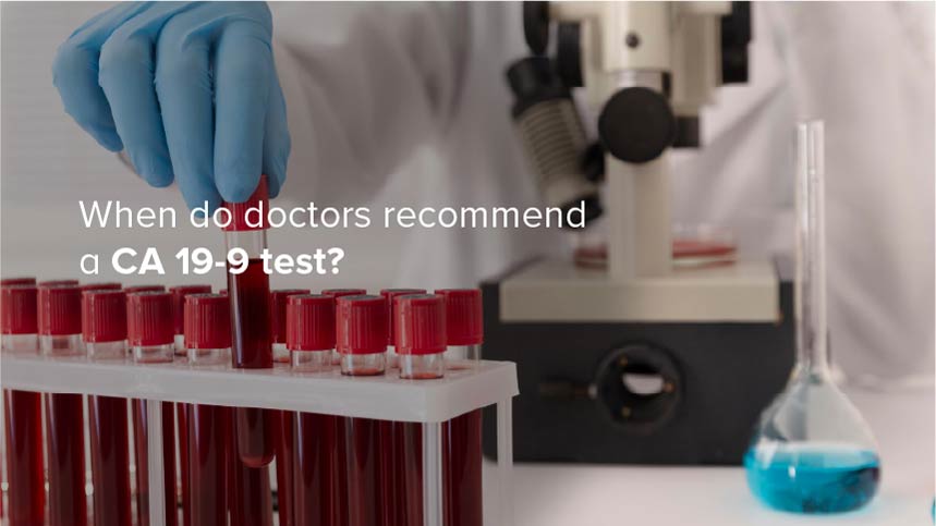 When Do Doctors Recommend a CA 19-9 Test?