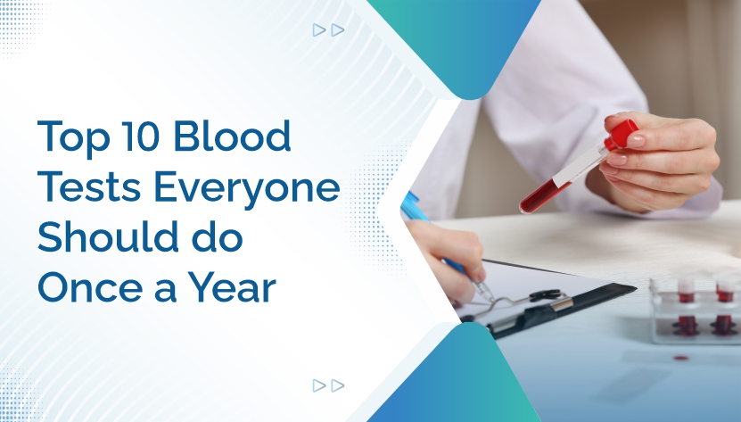 Have A Blood Routine Test Top 10 Blood Tests Everyone Should Do Once a Year
