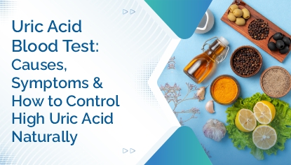 Uric Acid Blood Test Causes, Symptoms & How to Control High Uric Acid Naturally