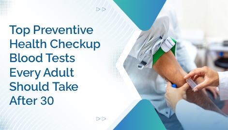 Top Preventive Health Checkup Blood Tests Every Adult Should Take After 30