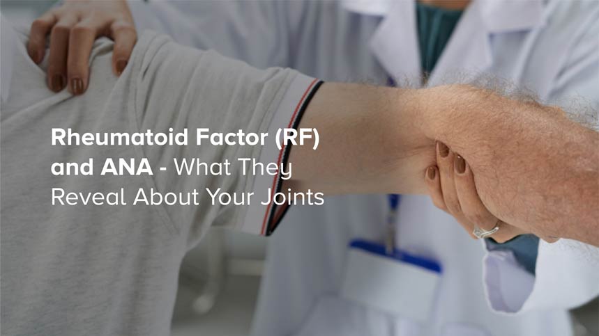 Rheumatoid Factor (RF) and ANA – What They Reveal About Your Joints