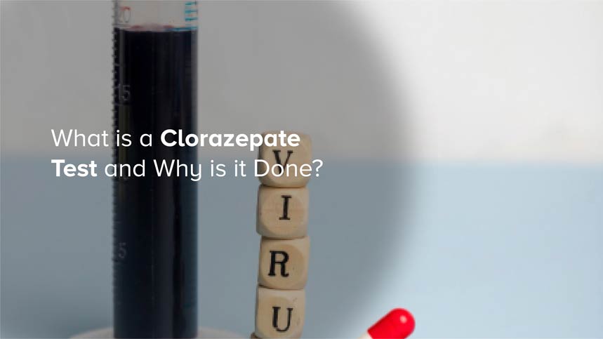 What is a Clorazepate Test and Why is it Done?